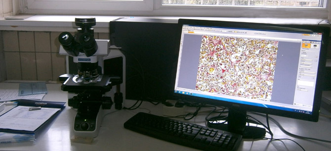 Dva mikroskopa klinikama u Nišu i Beogradu